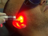 Biostimolazione ATM - Durante il trattamento laser